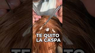 TE QUITO LA CASPA asmr shorts asmrvideo comedia [upl. by Aurlie]