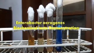 Enterobacter aerogenes Biochemical tests Demonstration [upl. by Socher]