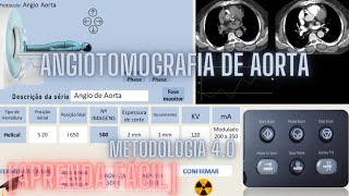 APRENDA FÁCIL ANGIOTOMOGRAFIA DE AORTA [upl. by Mateya44]