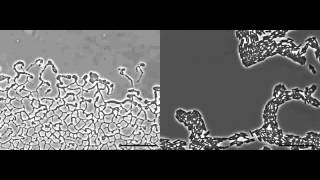 Quorum sensing in bacteria  vibrio harveii [upl. by Bank184]