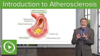 Introduction to Atherosclerosis  Cellular Pathology [upl. by Lubeck]