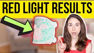 DO LED LIGHT MASKS REALLY WORK  Dermatologist reviews Omnilux [upl. by Krutz662]