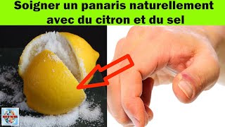 La méthode citron et sel révélée  Soignez votre panaris de manière efficace sans médicaments [upl. by Ggerc861]