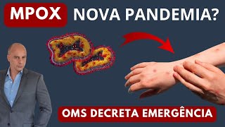 Mpox OMS Decreta EMERGÊNCIA Nova PANDEMIA  Dr Moacir Rosa [upl. by Ainit145]