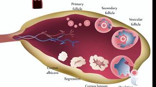 Ovarian Cysts [upl. by Kennard]