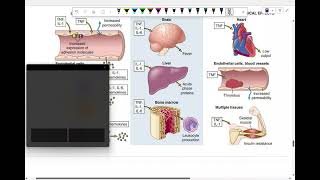 Into to pathology tissue inflammation 6 [upl. by Hike]