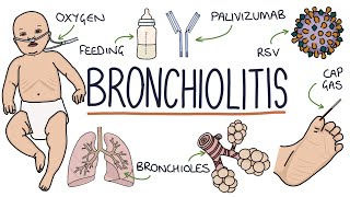 Understanding Bronchiolitis [upl. by Janka]