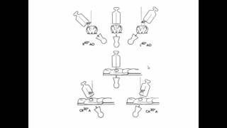 Angiographic views and equipment [upl. by Carlene]