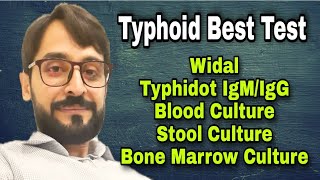 Typhoid Best Test [upl. by Asemaj413]