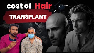 Cost of Hair transplant  Naku subscriber antha pay chesadu [upl. by Niassuh85]