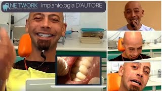 IMPLANTOLOGIA DENTALE PREZZI [upl. by Rann]