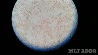 filaria live seen in microscopic examination [upl. by Anaitit]