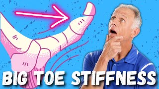 Big Toe PainStiffness Hallux Rigidus 10 Steps to Cure [upl. by Einafit]