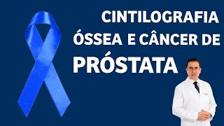 Cintilografia Óssea e Câncer de Próstata  IMEB [upl. by Bambie]