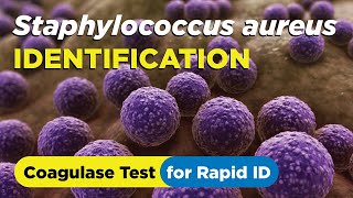 How to identify Staphylococcus aureus using the Coagulase Test  Slide and Tube Method [upl. by Connelly]