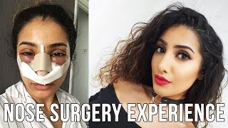 My Nose Surgery Experience VLOG [upl. by Alamat]