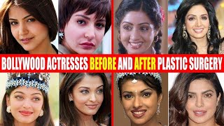 SURGERY WENT WRONG CELEBRITIES [upl. by Ecyor]