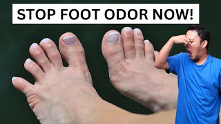 4 WAYS to STOP FOOT ODOR FAST [upl. by Rabaj59]