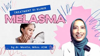 Treatment Melasma Di Klinik Kecantikan [upl. by Einned956]