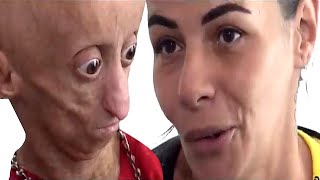 Reportage special RANIA Complet Interview avec sa Mere Maladie Progeria Nanisme Didek74 [upl. by Columbyne]