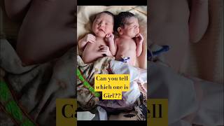 Cutest Twin Newborn Baby girl amp Baby boy First Cry immediately AfterBirth [upl. by Jewell]