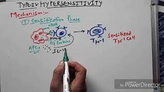 Hypersensitivity type 4 hindi [upl. by Elleb]