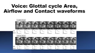 Voice Glottic AreaAirflow and Contact [upl. by Akedijn]