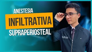 Anestesia infiltrativa ou supraperiosteal  anestesiologia [upl. by Dnumyar]