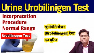 Urine Urobilinogen Test in Hindi   Ehrlichs aldehyde test [upl. by Wall]