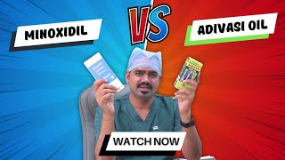 Minoxidil vs Adivasi Hair Oil Which One Really Works adivasioil minoxidil adivasihairoilreview [upl. by Atiuqram]