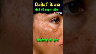 डिलीवरी के बाद चेहरे की झाइयां ठीक करने का उपाय melasma chloasma skincare [upl. by Nitnert564]