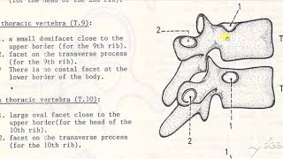 Atypical thoracic vertebrae 4 [upl. by Shelden]