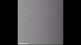 FastDividing Bacteria Help Make CavityCausing Tooth Plaque [upl. by Rebeh]