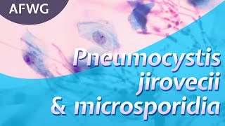 Latest on P jirovecii microsporidia – Prof D Marriott [upl. by Korella669]