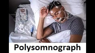 Polysomnography  Sleep Technician  What is Polysomnogram [upl. by Verner]