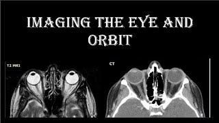 CT MRI eye and orbit [upl. by Asilanom]