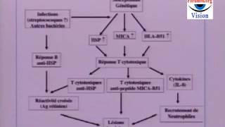 Les Symptômes de la Maladie de Behçet [upl. by Nylcsoj522]