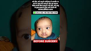 Free Cleft Lip and Palate Surgery at Saraswat Hospital Agra [upl. by Eniahpets]