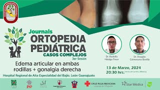 Journal Ortopedia Pediátrica Edema articular en ambas rodillas  gonalgia derecha [upl. by Jud]