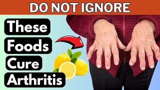 Best Foods For Arthritis  Health Club [upl. by Ydassac]