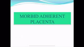 Retained placenta n morbid adherent placenta [upl. by Munmro301]