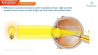 Refractive errors of eye 🌟👁️ Ophthalmology lectures [upl. by Ycniuqed]