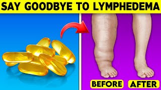 Unlock The Hidden Secrets To Beat Lymphedema [upl. by Malin322]