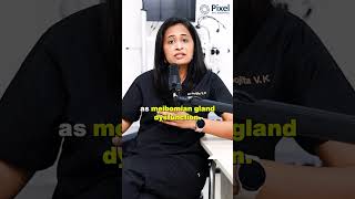 Meibomian gland dysfunction  Dr Krishna poojita  eye meibomian dryeyesyndrome dryeyetreatment [upl. by Uol774]