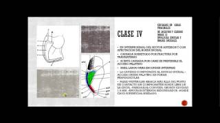 Clasificación de las cavidades dentales según Dr Black y la NUEVA ADICION CLASE VI [upl. by Berky]