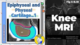 Fig 5B18 Normal Epiphyseal and Physeal Cartilage Part 1 [upl. by Yngiram]