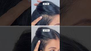 Plum Rosemary and Redensyl Hair Growth Serum Review [upl. by Ardnikat]