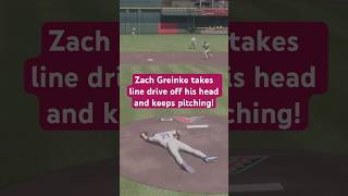 Zack Greinke Takes Line Drive Off His HEAD [upl. by Ycniuq]