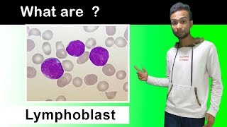 What are Lymphoblast Cells  Complete Overview [upl. by Sterner633]