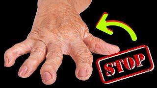 Arthritis Warning NEVER Eat These 8 Foods😱 [upl. by Dutch]